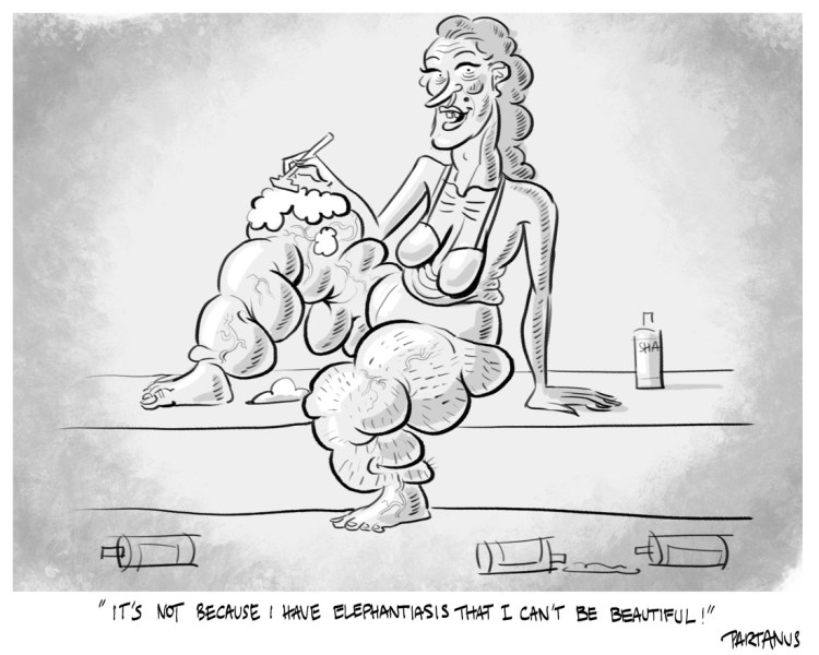 cartoon, elephantiasis, "shaving legs"